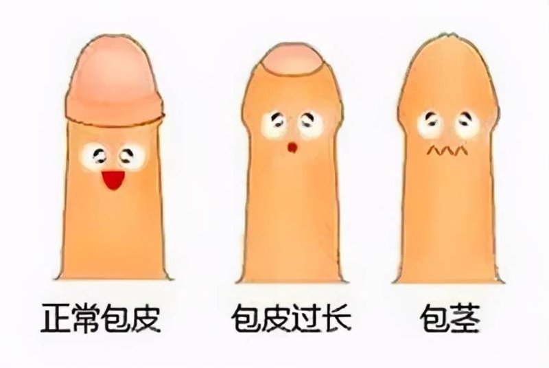 泌尿外科领域，女性医生是否值得信赖？